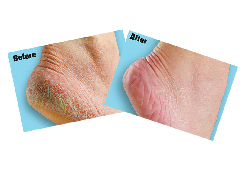 Gorilla Glue O'Keeffe's Healthy Feet Foot Cream 85g Tube GRGOKHF85G