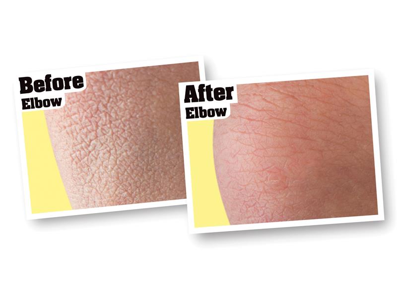 Gorilla Glue O'Keeffe's Skin Repair Body Lotion 190ml Tube GRGOKSR190ML